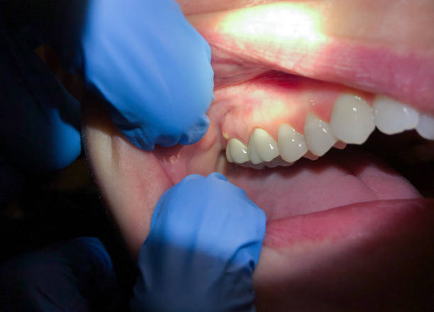 Best Emergency Dental Care for Trauma or Injury in Secaucus, NJ