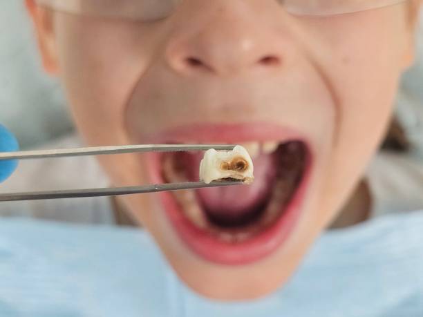 Best Emergency Treatment for Toothache in Secaucus, NJ